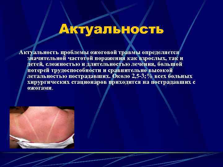 Актуальность проблемы ожоговой травмы определяется значительной частотой поражения как взрослых, так и детей, сложностью