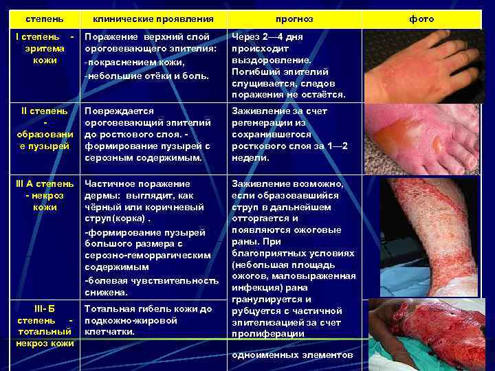 степень клинические проявления прогноз I степень - Поражение верхний слой эритема ороговевающего эпителия: кожи