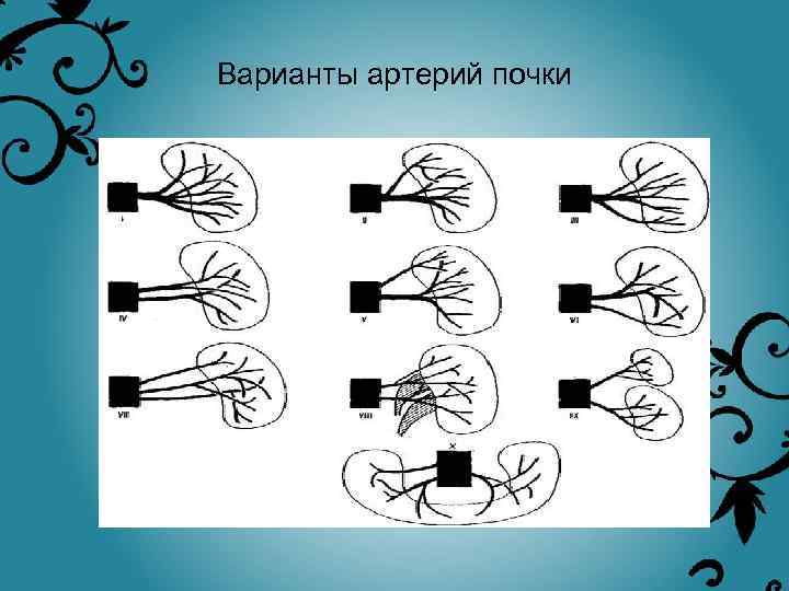 Варианты артерий почки 