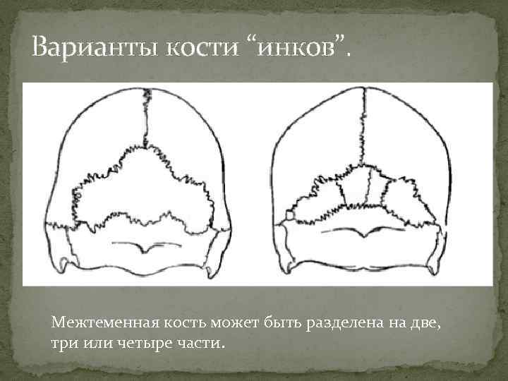 Швы лобной кости