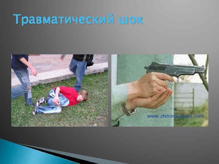 Травматический шок 