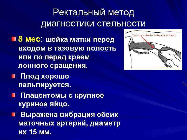 Диагностика беременности презентация