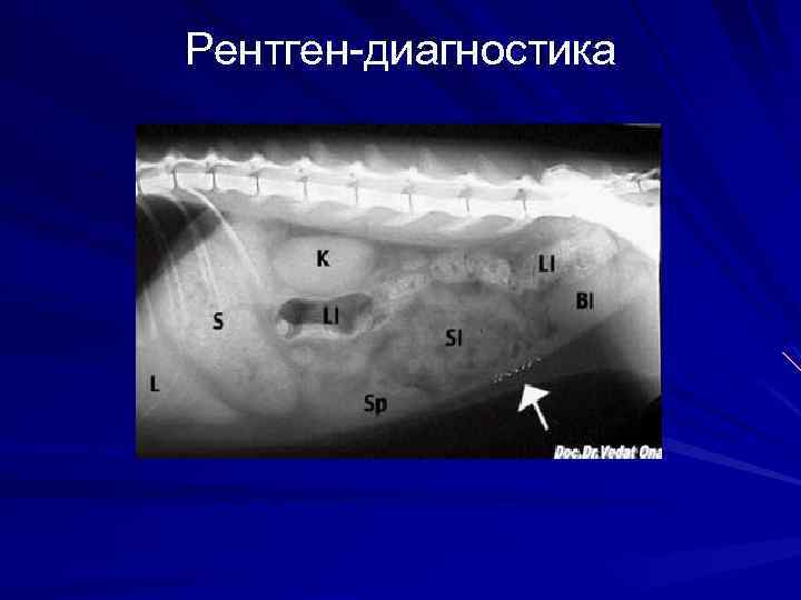 Рентген-диагностика 