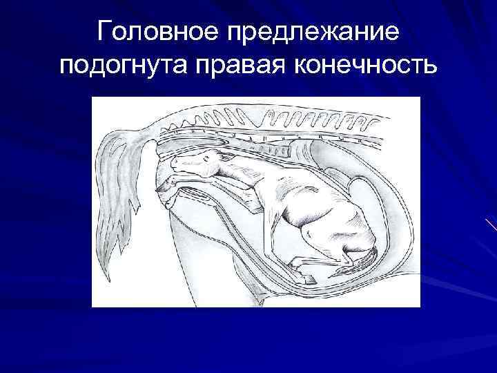 Головное предлежание подогнута правая конечность 