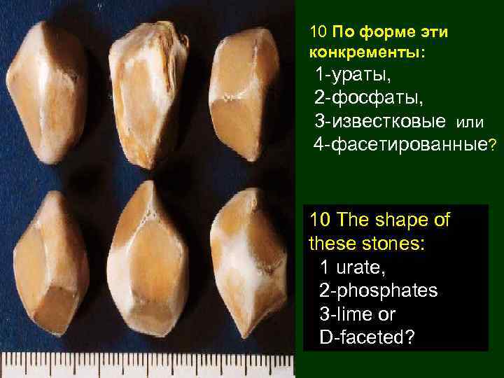 10 По форме эти конкременты: 1 -ураты, 2 -фосфаты, 3 -известковые или 4 -фасетированные?