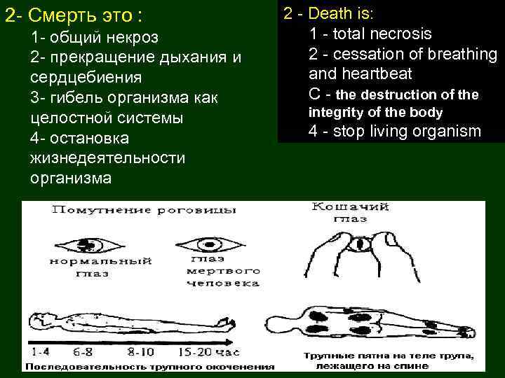 2 - Смерть это : 1 - общий некроз 2 - прекращение дыхания и