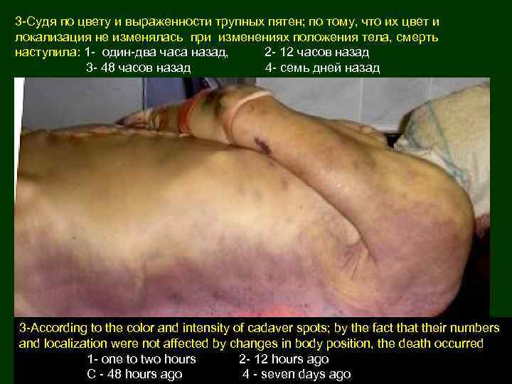 3 -Судя по цвету и выраженности трупных пятен; по тому, что их цвет и