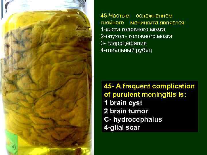 45 -Частым осложнением гнойного менингита является: 1 -киста головного мозга 2 -опухоль головного мозга
