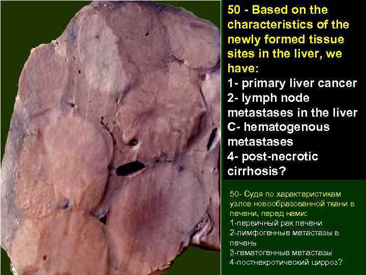 50 - Based on the characteristics of the newly formed tissue sites in the