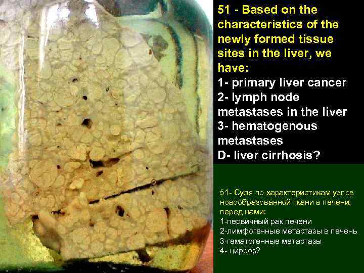 51 - Based on the characteristics of the newly formed tissue sites in the