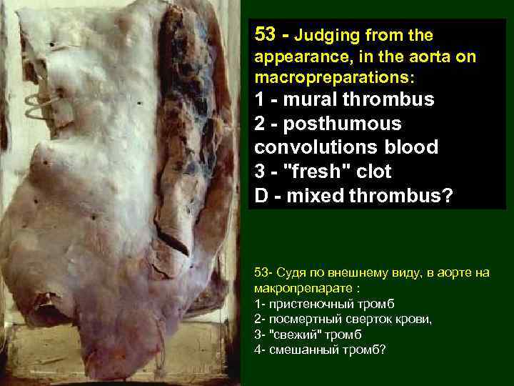53 - Judging from the appearance, in the aorta on macropreparations: 1 - mural