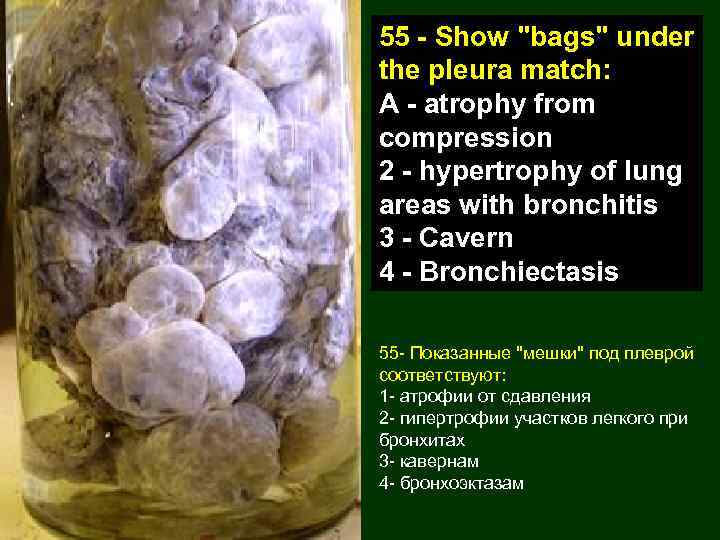 55 - Show "bags" under the pleura match: A - atrophy from compression 2