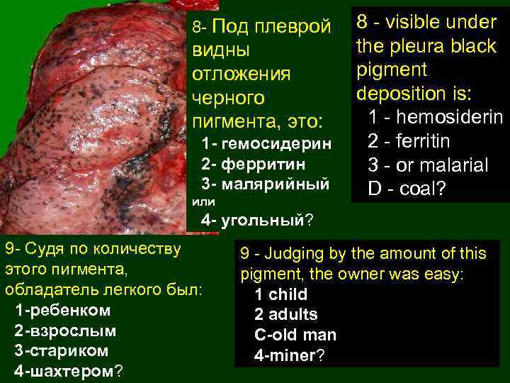 8 - Под плеврой видны отложения черного пигмента, это: 1 - гемосидерин 2 -