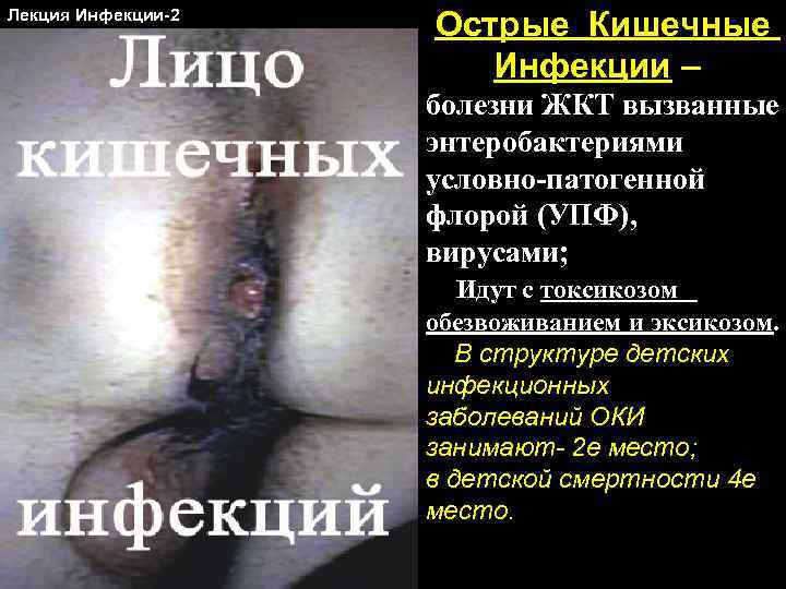 Лекция Инфекции-2 Острые Кишечные Инфекции – болезни ЖКТ вызванные энтеробактериями условно-патогенной флорой (УПФ), вирусами;