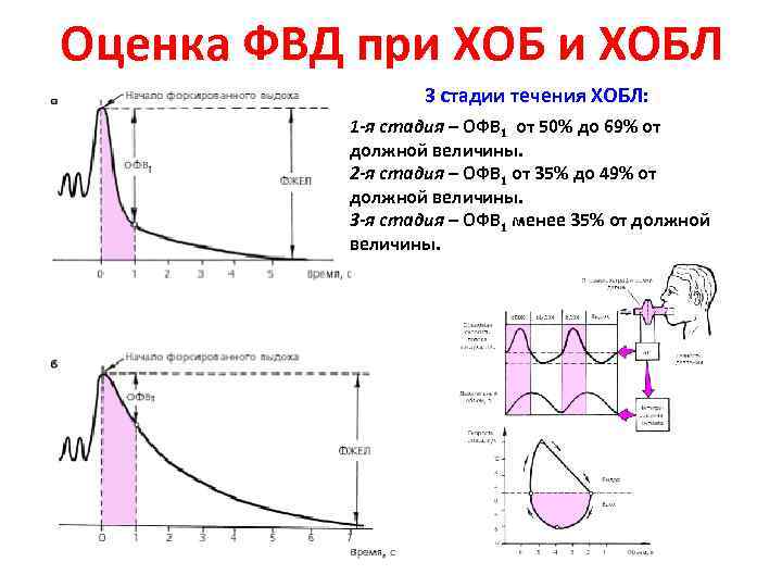 Хронический бронхит карта вызова