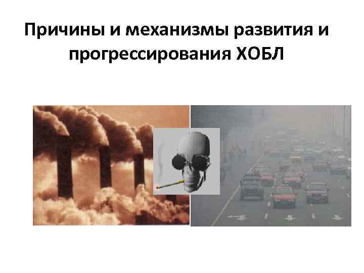 Причины и механизмы развития и прогрессирования ХОБЛ 