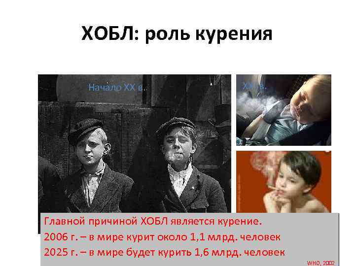 ХОБЛ: роль курения Начало XX в. XXI в. Главной причиной ХОБЛ является курение. 2006