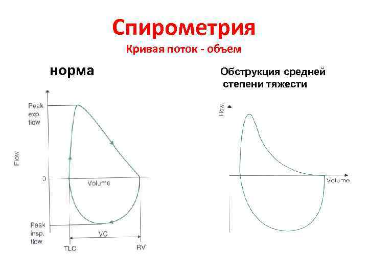 Спирометрия что это