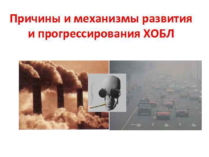 Причины и механизмы развития и прогрессирования ХОБЛ 