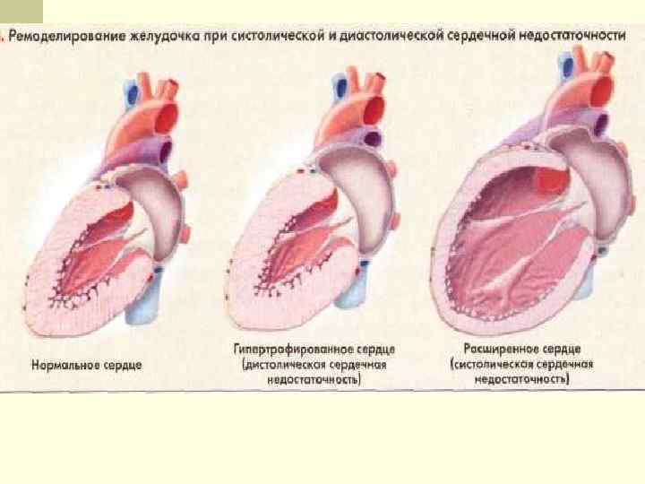 Особенности первого этапа сестринского процесса при хронической недостаточности кровообращения схема