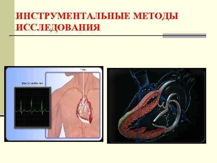 ИНСТРУМЕНТАЛЬНЫЕ МЕТОДЫ ИССЛЕДОВАНИЯ 