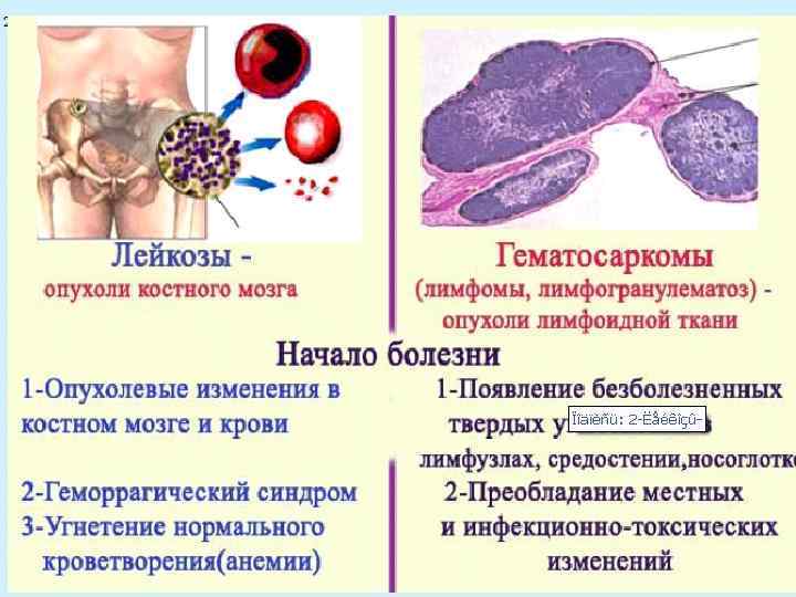 Кровотечения при лейкозе. Цвет крови при лейкемии. Причины анемии при лейкозах. Цвет крови при лейкозе лейкемии.