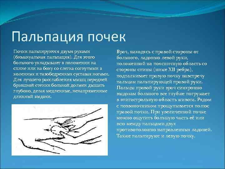 Пальпация почек Почки пальпируются двумя руками (бимануальная пальпация). Для этого больного укладывают в положении