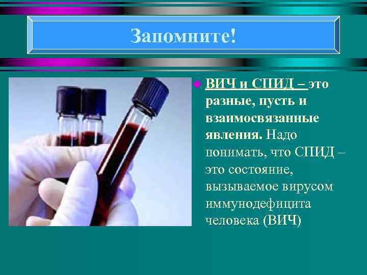 Запомните! u ВИЧ и СПИД – это разные, пусть и взаимосвязанные явления. Надо понимать,