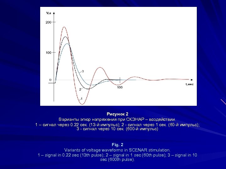 Рисунок 2 Варианты эпюр напряжения при СКЭНАР – воздействии. 1 – сигнал через 0.