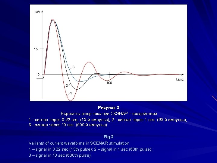 Рисунок 3 Варианты эпюр тока при СКЭНАР – воздействии 1 - сигнал через 0.