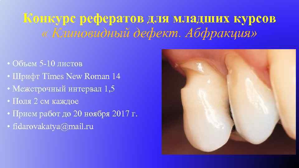 Конкурс рефератов для младших курсов « Клиновидный дефект. Абфракция» • Объем 5 -10 листов