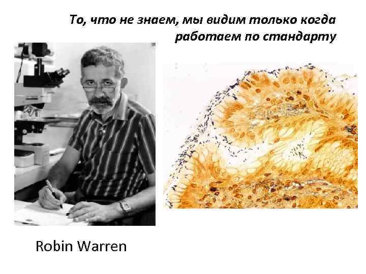 То, что не знаем, мы видим только когда работаем по стандарту Robin Warren 