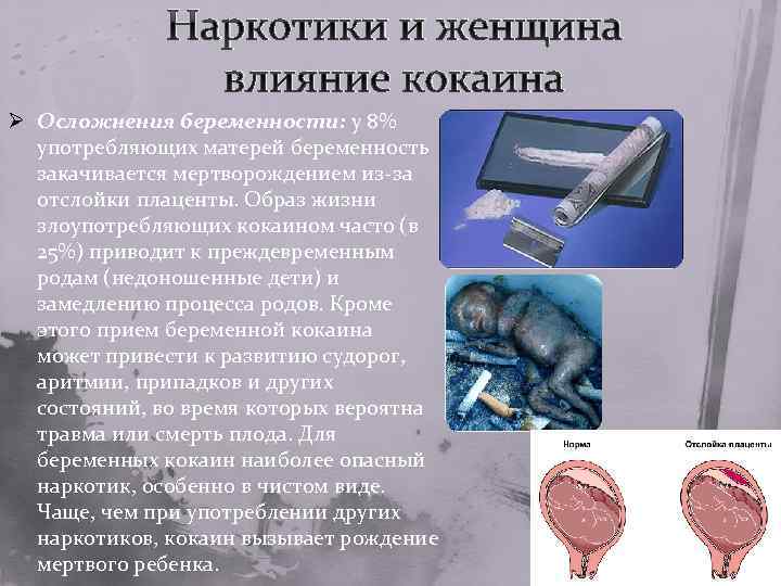 Наркотики и женщина влияние кокаина Ø Осложнения беременности: у 8% употребляющих матерей беременность закачивается