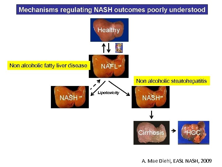 Non alcoholic fatty liver disease Non alcoholic steatohepatitis A. Mae Diehl, EASL NASH, 2009