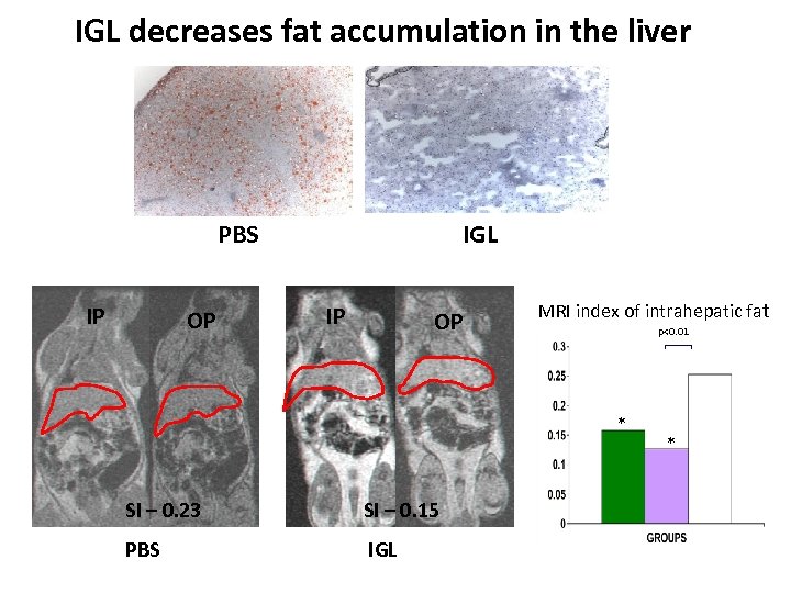 IGL decreases fat accumulation in the liver PBS IP OP IGL IP OP MRI