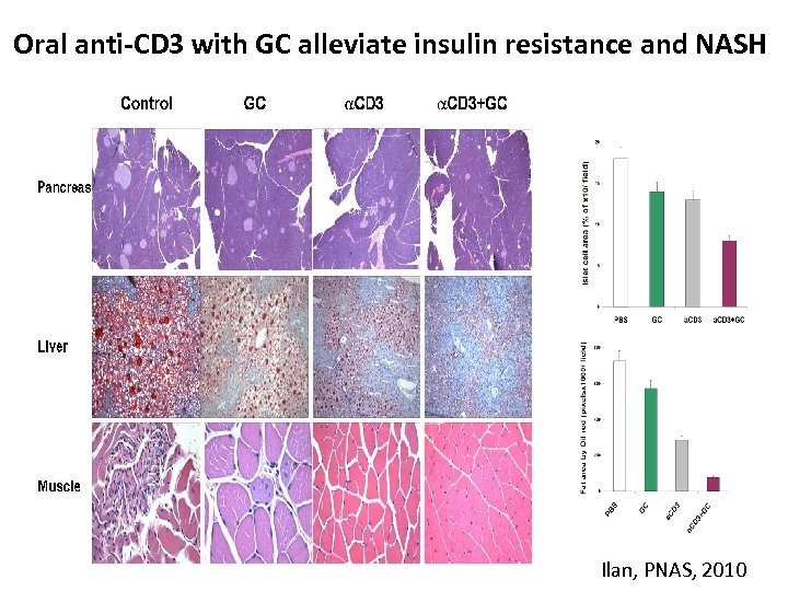Oral anti-CD 3 with GC alleviate insulin resistance and NASH Ilan, PNAS, 2010 