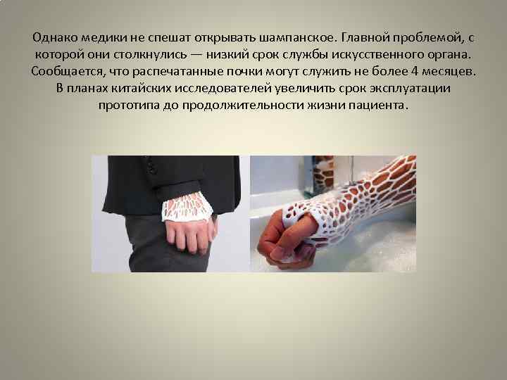 Однако медики не спешат открывать шампанское. Главной проблемой, с которой они столкнулись — низкий