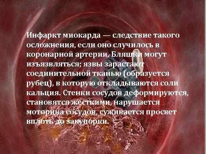 Инфаркт миокарда — следствие такого осложнения, если оно случилось в коронарной артерии. Бляшки могут