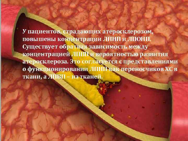 У пациентов, страдающих атеросклерозом, повышены концентрации ЛПНП и ЛПОНП. Существует обратная зависимость между концентрацией