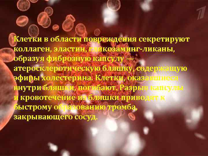  Клетки в области повреждения секретируют коллаген, эластин, гликозаминг-ликаны, образуя фиброзную капсулу — атеросклеротическую