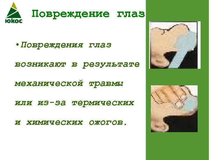 Повреждение глаз • Повреждения глаз возникают в результате механической травмы или из-за термических и