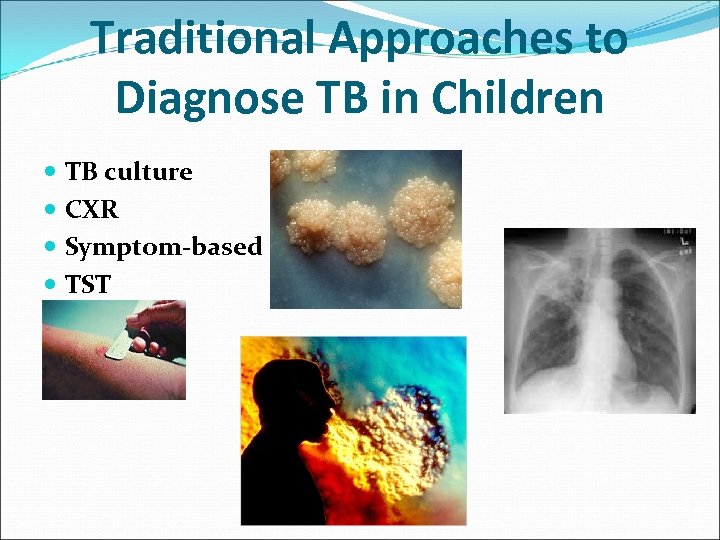 Traditional Approaches to Diagnose TB in Children TB culture CXR Symptom-based TST 