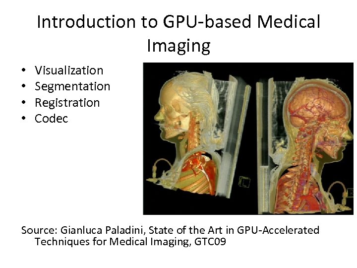 Introduction to GPU-based Medical Imaging • • Visualization Segmentation Registration Codec Source: Gianluca Paladini,