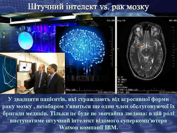 Штучний інтелект vs. рак мозку У двадцяти пацієнтів, які страждають від агресивної форми раку