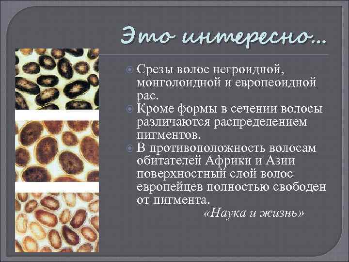 Это интересно… Срезы волос негроидной, монголоидной и европеоидной рас. Кроме формы в сечении волосы