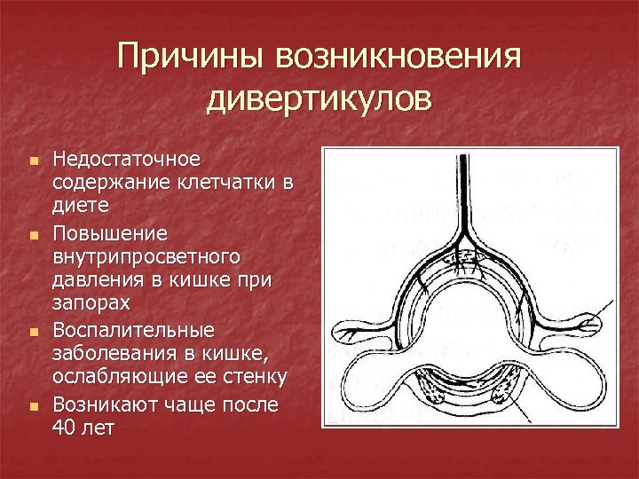 Причины возникновения дивертикулов n n Недостаточное содержание клетчатки в диете Повышение внутрипросветного давления в