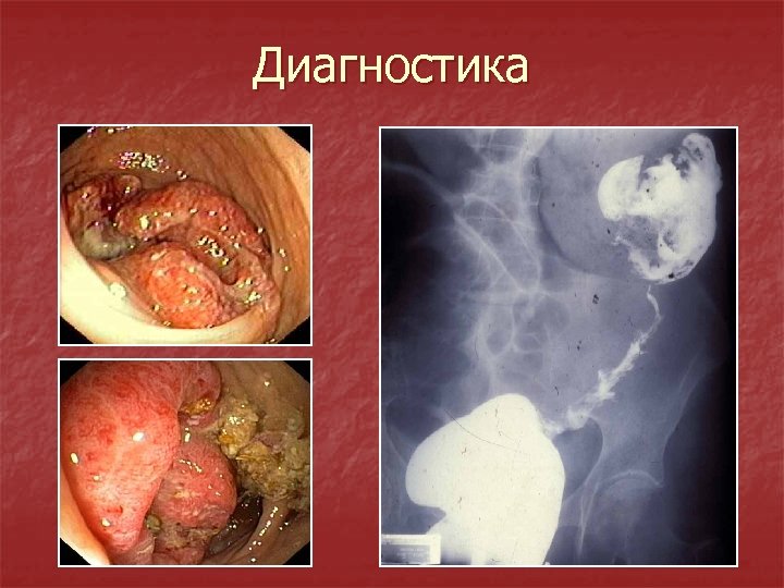 Диагностика 