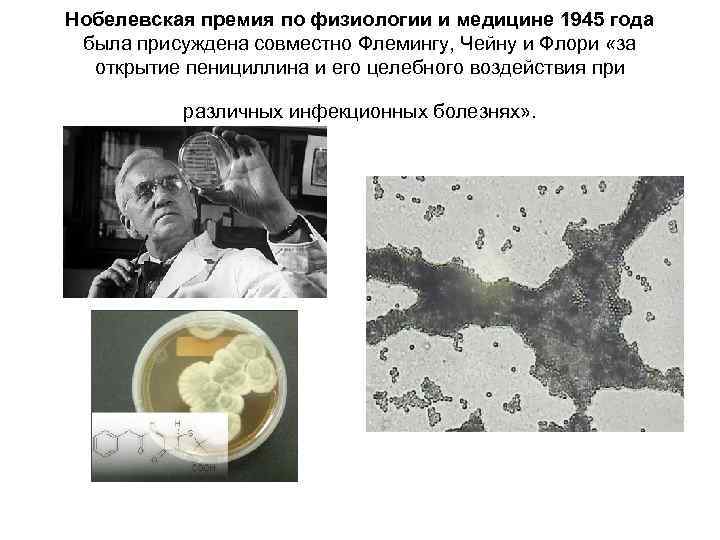 Нобелевская премия по физиологии и медицине 1945 года была присуждена совместно Флемингу, Чейну и