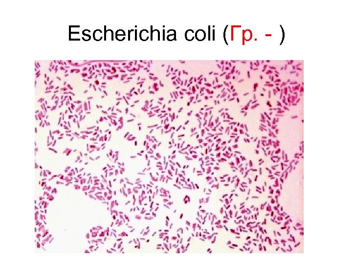 Escherichia coli (Гр. - ) 