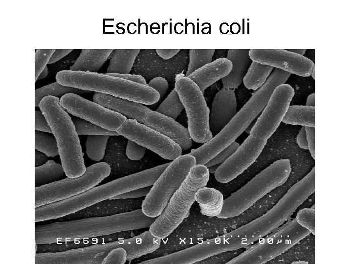 Escherichia coli 